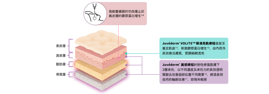 Juvederm Feature visual_2-2